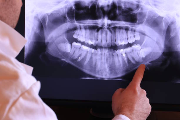 Best Emergency Dental Services for Seniors in Byram, CT