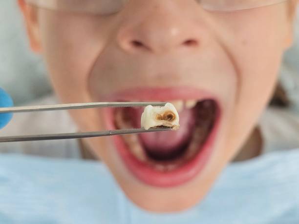 Best Urgent Dental Care for Toothache in Byram, CT